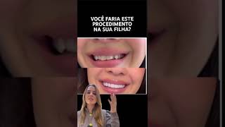 VOCÊ FARIA ESTE PROCEDIMENTO NA SUA FILHA dentista odontologia odontologiaestetica [upl. by Annauqahs]