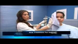 Keloid amp Hypertrophic Scar treatment using Cryoshape on quotThe Doctors TVquot [upl. by Annaohj977]