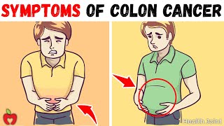 10 Warning Signs of Colon Cancer You Shouldn’t Ignore [upl. by Ennaed]