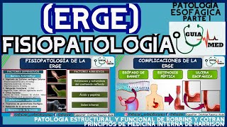 ENFERMEDAD POR REFLUJO GASTROESOFÁGICO FISIOPATOLOGÍA  GuiaMed [upl. by Frodi]