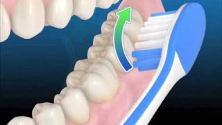 Técnica de higiene con cepillo manual [upl. by Arak]