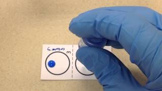 Microbiology  Coagulase [upl. by Moria]