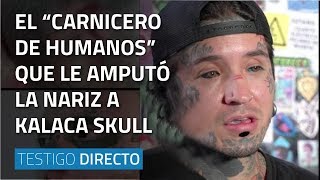 El “carnicero de humanos” que le amputó la nariz a Kalaca Skull  Testigo Directo HD [upl. by Barbie]