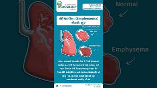 What is a emphysemaemphysemaempyemapneumothoraxhydrothoraxhemothoraxpyothorax [upl. by Lune]