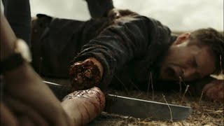 Fear The Walking Dead S03E12  Amputating Jake’s Arm [upl. by Terri]