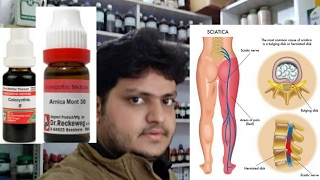 homeopathic medicine for treatment of sciatica explain [upl. by Ainala574]