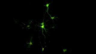 Monitoring spontaneous synaptic activity in neurons with GCaMP6s 2 [upl. by Johst]