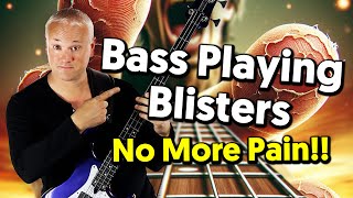 Bass Playing Tips For Avoiding Blisters and Sore Fingers  Its All In The Amp Settings [upl. by Anytsyrk]