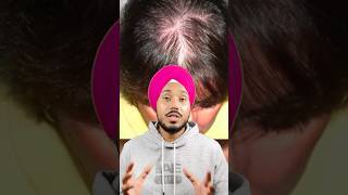 Jatamansi Hair Growth Remedy Natural Solution for Stronger Roots amp Regrowth reducehairfall [upl. by Cassidy]