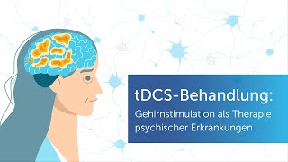 Elektrostimulation bei Depression tDCSTherapie einfach erklärt [upl. by Suitangi]