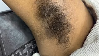 First Time UnderarmsArmpit Full growth Shave with Straight RazorArmpit shave armpit [upl. by Erroll853]