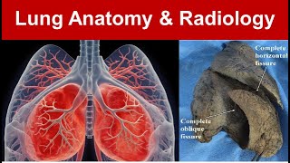 Lung Anatomy amp Radiology Gross Features Surfaces Borders and Azygous Lobe Part 1 TaimTalksMed [upl. by Enael]