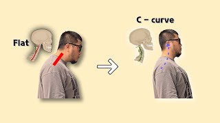일자목 목 C자 커브 5분만에 바로 잡는 방법 [upl. by Yesor]