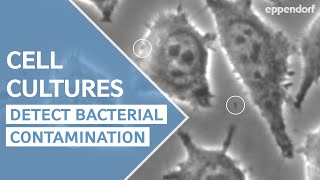 How to detect bacterial contamination in cell culture  moving particles are not always bacteria [upl. by Zelda]