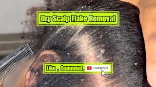 Dry scalp Flake removal [upl. by Donavon719]