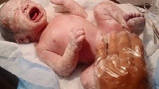 New born female baby delivred with lscs baby having a vernix and blood clots removed with baby oil❣️ [upl. by Comptom]