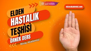 Elden Hastalık Teşhisi Örnek Ders 3 [upl. by Delfeena]