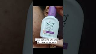 Lacto calamine face lotion review lacto calamine lotion for acne prone skin review shorts [upl. by Rabassa]