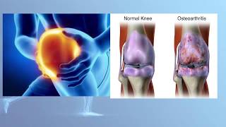 5 Best Prescription Arthritis Creams For Joint Pain [upl. by Nenerb707]