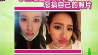 【現在才知道】1403061 微整後嘴唇腫到爆Plastic Surgeries quotKnow Howquot [upl. by Philina]