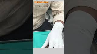 How Lignocaine Is Given Xylocaine कैसे दिया जाता है drsubhashkumar anaesthesia [upl. by Schlessinger]