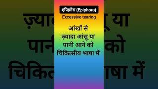 एपिफ़ोराEpiphoraExcessive tearingएपिफोरा का अर्थ क्या हैWhat is epiphora of the eye [upl. by Helms]