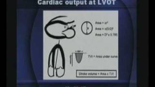 Basics Of Echocardiography Part2series2 [upl. by Frendel]