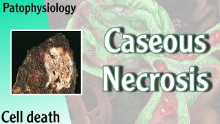 Pathophysiology  Caseous Necrosis Hani Laith شرح [upl. by Namlaz266]