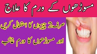 masoro me waram ka ilaj in urduGums Swelling Treatment [upl. by Noreik]