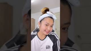 Pimple Patch Removal Compilation  Belo AcnePro Pimple Patch  G21 Hydrocolloid Pimple Patches [upl. by Cassandra157]