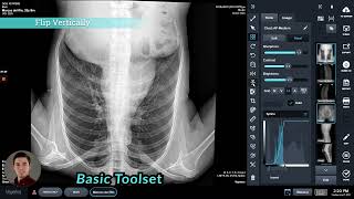 Voyance Digital Xray Software  Tools Overview [upl. by Fax785]