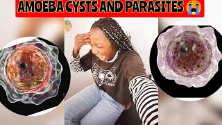 DIAGNOSED WITH AMOEBA CYSTS AFTER HAVING SEVERE STOMACH PAINS BACKPAINS AND BLOODY DIARRHOEA 😭😭 [upl. by Wasson]