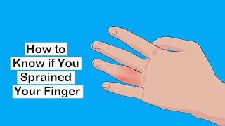 How Do You Know if Your Finger is Sprained Jammed Finger Treatment Home Remedies [upl. by Assirol]