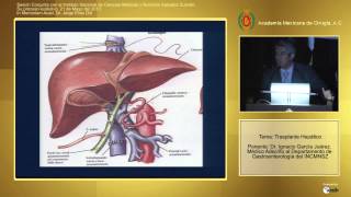 Trasplante Hepático  Dr Ignacio García Juárez  21 de Mayo del 2013 [upl. by Raul]