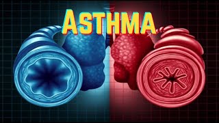 Asthma update 2019  CRASH Medical Review Series [upl. by Otilopih]