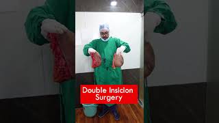 Double Insicion surgery cost  Double Insicion surgery Short shortvideo independenceday [upl. by Volny175]