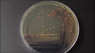 Colors  Bacterial Pigments TimeLapse [upl. by Masson]