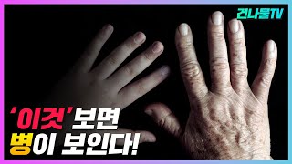 한번 나빠지면 되돌릴 수 없는 신호 신장이 망가지고 위암간암폐암까지 올 수 있는 10가지 증상 [upl. by Miller]