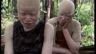 Deadly Hunt Albinos in Tanzania [upl. by Eednam]