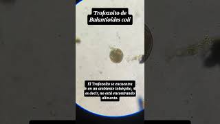 Trofozoito y Quiste de Balantioides coli Antiguamente conocido como Balantidium coli [upl. by Mayer]