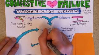 Congestive Heart Failure Pathophysiology [upl. by Emersen]