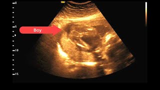 23 weeks 0 days pregnancy  Normal pregnancy  Babys Development [upl. by Yesnyl]