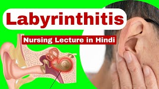 Labyrinthitis  causes symptoms management  medical surgical nursing  nursing lecture in hindi [upl. by Plunkett446]