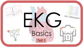 EKG Basics  Step by Step  Grundlagen Einthoven Frequenz Lagetyp PWelle QRS EKGKurs [upl. by Massie142]