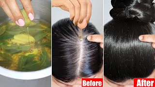 I applied👆🏼this Hair Tonic DailyIt Stopped Hairfall in 1 UseGot Double Thick Shiny Hair Growth💯 [upl. by Analeh]