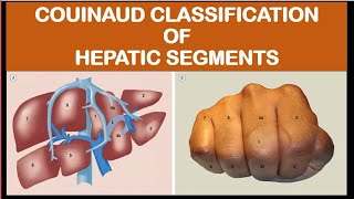 Anatomy of hepatic segments [upl. by Alyekahs]