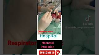 Respiratory support for a neonate intubation [upl. by Annoit]