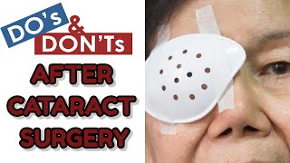 DOS AND DONTS AFTER CATARACT SURGERY EYE CARE TIPS AFTER CATARACT SURGERY [upl. by Aliuqet]