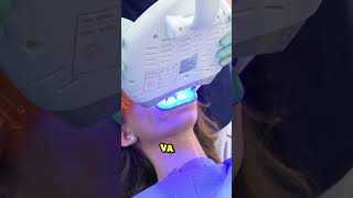 Blanqueamiento dental de terror dientes dentista tips parati viral fyp shorts shortvideo [upl. by Tabina]