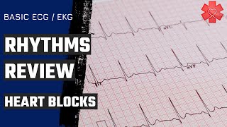 Basic ECG EKG Part 5 Heart Blocks [upl. by Stuckey151]